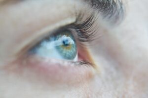 ojo
